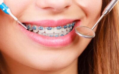 La prevención en salud bucodental como base para una sonrisa sana