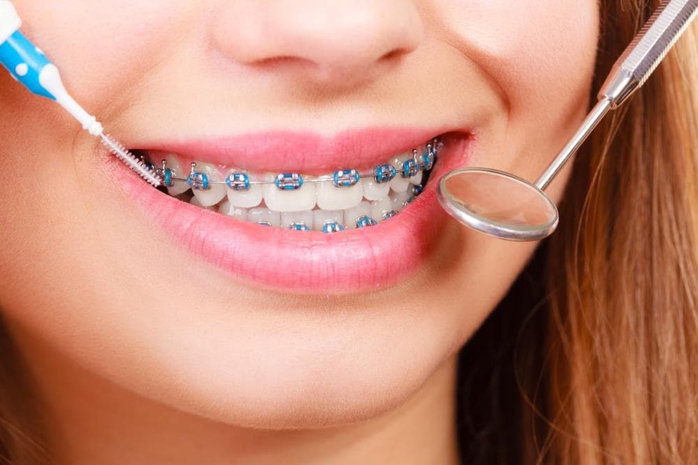La prevención en salud bucodental como base para una sonrisa sana